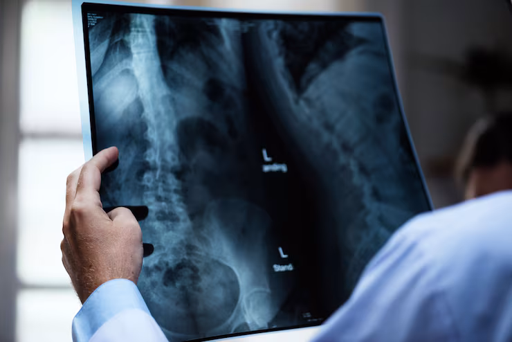 X-Ray & Radiology